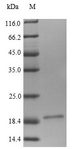 LRP4 Protein - (Tris-Glycine gel) Discontinuous SDS-PAGE (reduced) with 5% enrichment gel and 15% separation gel.