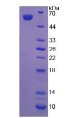 LRP4 Protein - Recombinant Low Density Lipoprotein Receptor Related Protein 4 By SDS-PAGE