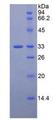 LRP5 Protein - Recombinant Low Density Lipoprotein Receptor Related Protein 5 By SDS-PAGE