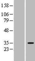 LRP5L Protein - Western validation with an anti-DDK antibody * L: Control HEK293 lysate R: Over-expression lysate