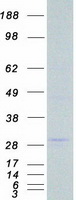 LRP5L Protein - Purified recombinant protein LRP5L was analyzed by SDS-PAGE gel and Coomassie Blue Staining