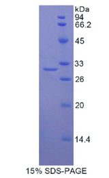 LRPAP1 Protein - Recombinant Low Density Lipoprotein Receptor Related Protein Associated Protein 1 By SDS-PAGE