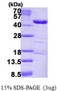 LRPAP1 Protein
