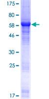 LRPB7 / LRRC23 Protein - 12.5% SDS-PAGE of human LRRC23 stained with Coomassie Blue