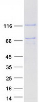 LRPPRC Protein - Purified recombinant protein LRPPRC was analyzed by SDS-PAGE gel and Coomassie Blue Staining