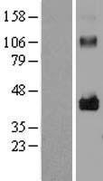 LRRC17 Protein - Western validation with an anti-DDK antibody * L: Control HEK293 lysate R: Over-expression lysate