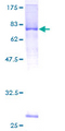 LRRC17 Protein - 12.5% SDS-PAGE of human LRRC17 stained with Coomassie Blue