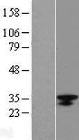 LRRC18 Protein - Western validation with an anti-DDK antibody * L: Control HEK293 lysate R: Over-expression lysate