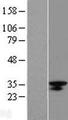 LRRC18 Protein - Western validation with an anti-DDK antibody * L: Control HEK293 lysate R: Over-expression lysate