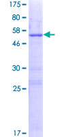 LRRC18 Protein - 12.5% SDS-PAGE of human LRRC18 stained with Coomassie Blue