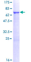 LRRC2 Protein - 12.5% SDS-PAGE of human LRRC2 stained with Coomassie Blue