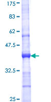 LRRC2 Protein - 12.5% SDS-PAGE Stained with Coomassie Blue.