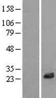LRRC20 Protein - Western validation with an anti-DDK antibody * L: Control HEK293 lysate R: Over-expression lysate