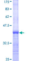 LRRC29 Protein - 12.5% SDS-PAGE Stained with Coomassie Blue.