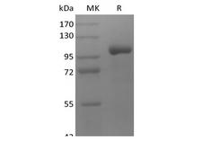 LRRC32 Protein - Recombinant Human LRRC32/GARP (C-Fc)