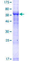 LRRC34 Protein - 12.5% SDS-PAGE of human LRRC34 stained with Coomassie Blue