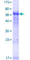 LRRC34 Protein - 12.5% SDS-PAGE of human LRRC34 stained with Coomassie Blue