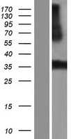 LRRC38 Protein - Western validation with an anti-DDK antibody * L: Control HEK293 lysate R: Over-expression lysate