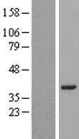 LRRC39 Protein - Western validation with an anti-DDK antibody * L: Control HEK293 lysate R: Over-expression lysate