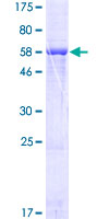 LRRC39 Protein - 12.5% SDS-PAGE of human LRRC39 stained with Coomassie Blue