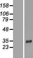 LRRC3B Protein - Western validation with an anti-DDK antibody * L: Control HEK293 lysate R: Over-expression lysate
