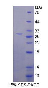 LRRC3C Protein - Recombinant Leucine Rich Repeat Containing Protein 3C (LRRC3C) by SDS-PAGE