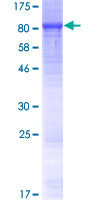 LRRC40 Protein - 12.5% SDS-PAGE of human LRRC40 stained with Coomassie Blue