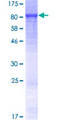 LRRC40 Protein - 12.5% SDS-PAGE of human LRRC40 stained with Coomassie Blue