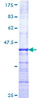 LRRC41 Protein - 12.5% SDS-PAGE Stained with Coomassie Blue.