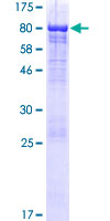 LRRC43 Protein - 12.5% SDS-PAGE of human LRRC43 stained with Coomassie Blue