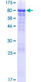 LRRC43 Protein - 12.5% SDS-PAGE of human LRRC43 stained with Coomassie Blue