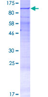 LRRC49 Protein - 12.5% SDS-PAGE of human LRRC49 stained with Coomassie Blue