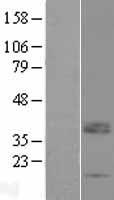 LRRC52 Protein - Western validation with an anti-DDK antibody * L: Control HEK293 lysate R: Over-expression lysate