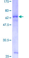 LRRC54 / TSK Protein - 12.5% SDS-PAGE of human LRRC54 stained with Coomassie Blue