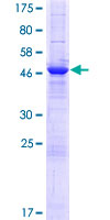 LRRC57 Protein - 12.5% SDS-PAGE of human LRRC57 stained with Coomassie Blue