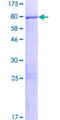 LRRC6 Protein - 12.5% SDS-PAGE of human LRRC6 stained with Coomassie Blue
