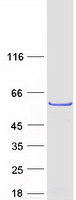 LRRC6 Protein - Purified recombinant protein LRRC6 was analyzed by SDS-PAGE gel and Coomassie Blue Staining