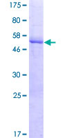 LRRC61 Protein - 12.5% SDS-PAGE of human LRRC61 stained with Coomassie Blue