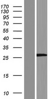 LRRC75A / C17orf76 Protein - Western validation with an anti-DDK antibody * L: Control HEK293 lysate R: Over-expression lysate