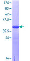 LRRC8A / LRRC8 Protein - 12.5% SDS-PAGE Stained with Coomassie Blue.