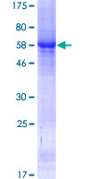 LRRIQ1 Protein - 12.5% SDS-PAGE of human LRRIQ1 stained with Coomassie Blue