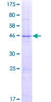 LRRIQ3 Protein - 12.5% SDS-PAGE of human LRRC44 stained with Coomassie Blue