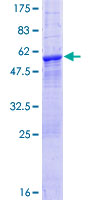 LRRK1 Protein - 12.5% SDS-PAGE of human LRRK1 stained with Coomassie Blue