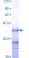 LRRK1 Protein - 12.5% SDS-PAGE Stained with Coomassie Blue.