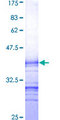 LRRK1 Protein - 12.5% SDS-PAGE Stained with Coomassie Blue.