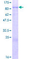 LRRN2 / GAC1 Protein - 12.5% SDS-PAGE of human LRRN2 stained with Coomassie Blue