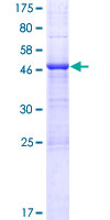 LRRN4CL Protein - 12.5% SDS-PAGE of human LOC221091 stained with Coomassie Blue
