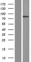 LRSAM1 Protein - Western validation with an anti-DDK antibody * L: Control HEK293 lysate R: Over-expression lysate