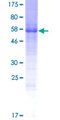 LRTM1 Protein - 12.5% SDS-PAGE of human LRTM1 stained with Coomassie Blue
