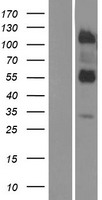 LRTM2 Protein - Western validation with an anti-DDK antibody * L: Control HEK293 lysate R: Over-expression lysate